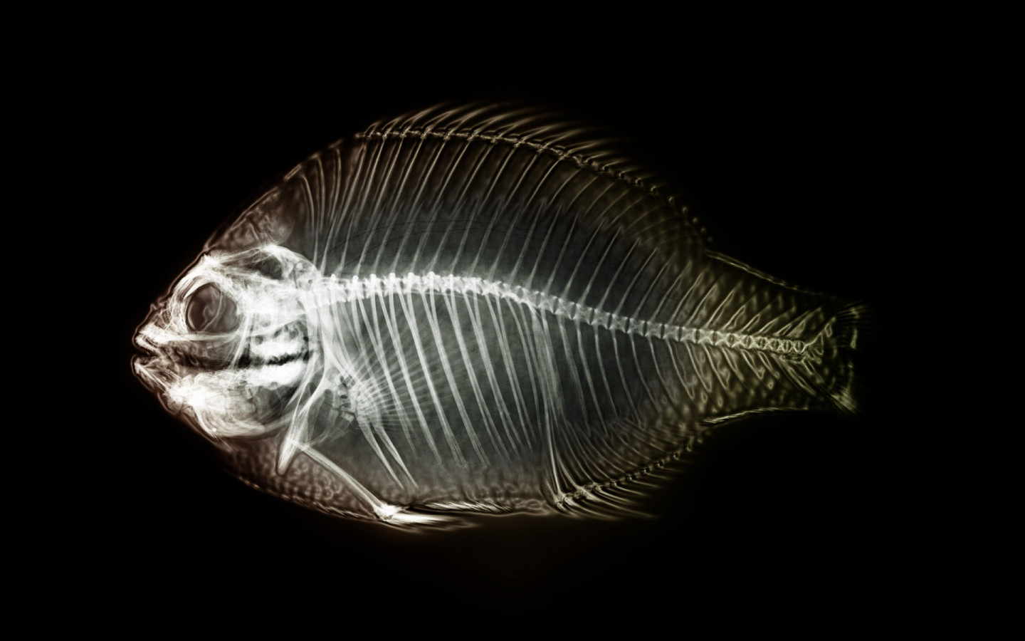 X-ray fish