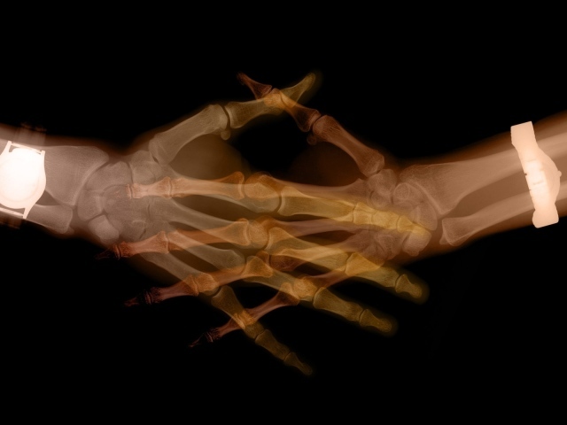 Сканер тела