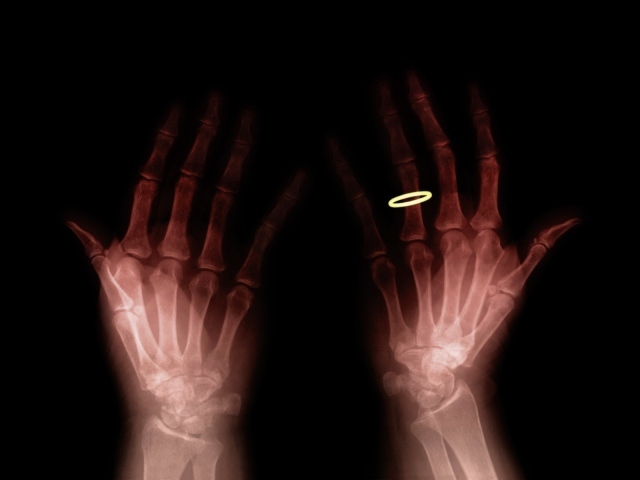 Просвечивать руки