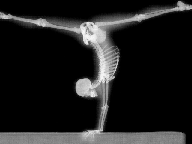 Рентген гимнаста