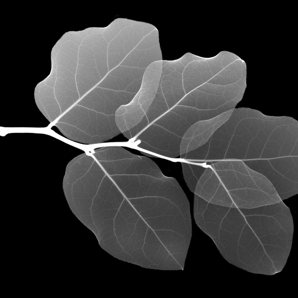 Рентген Листа