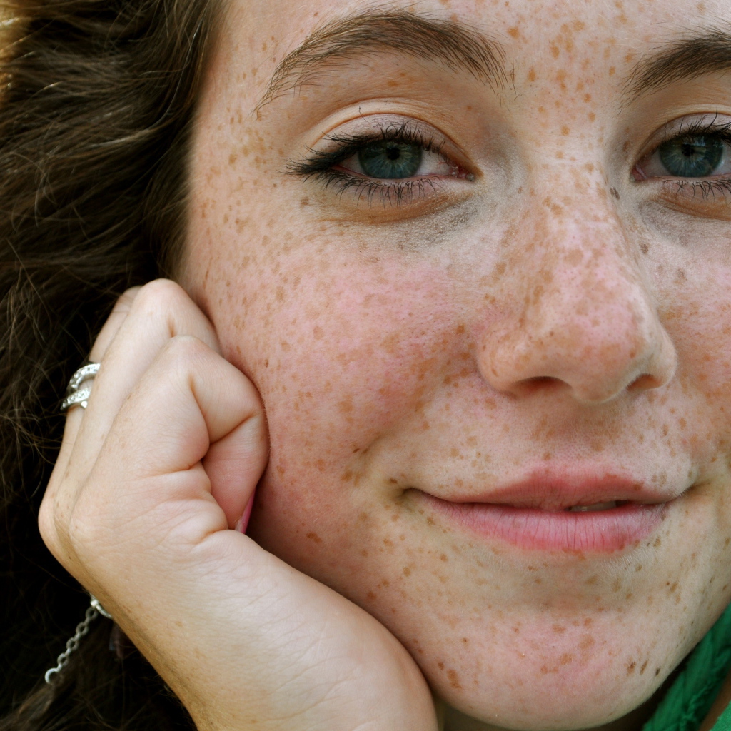 Голубоглазая девушка с веснушками