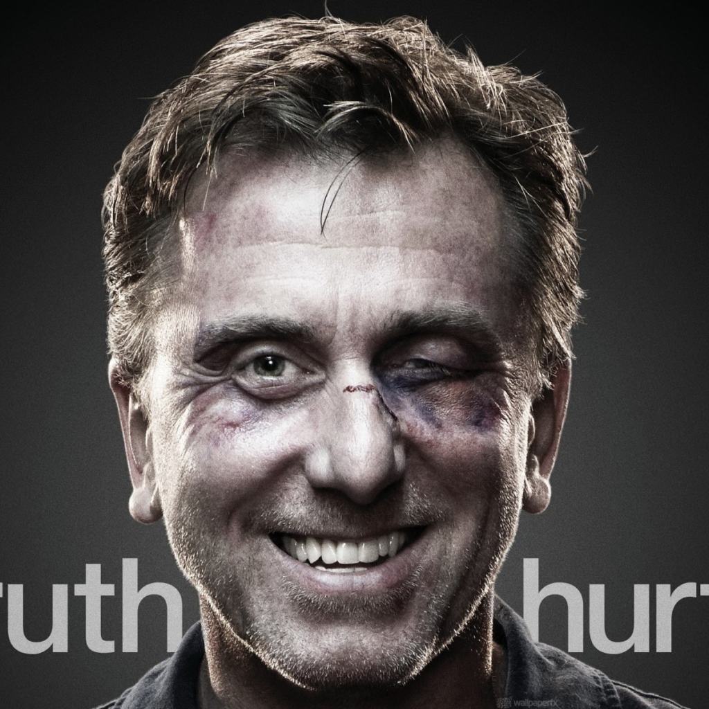 Актер с подбитым глазом