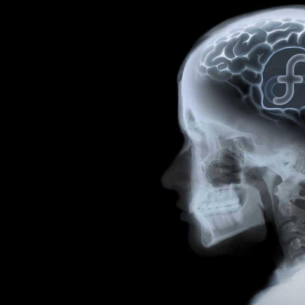 Знак ОС Fedora на рентгене