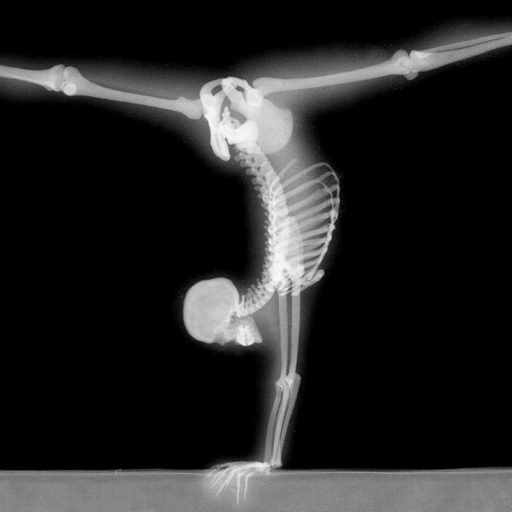 Рентген гимнаста