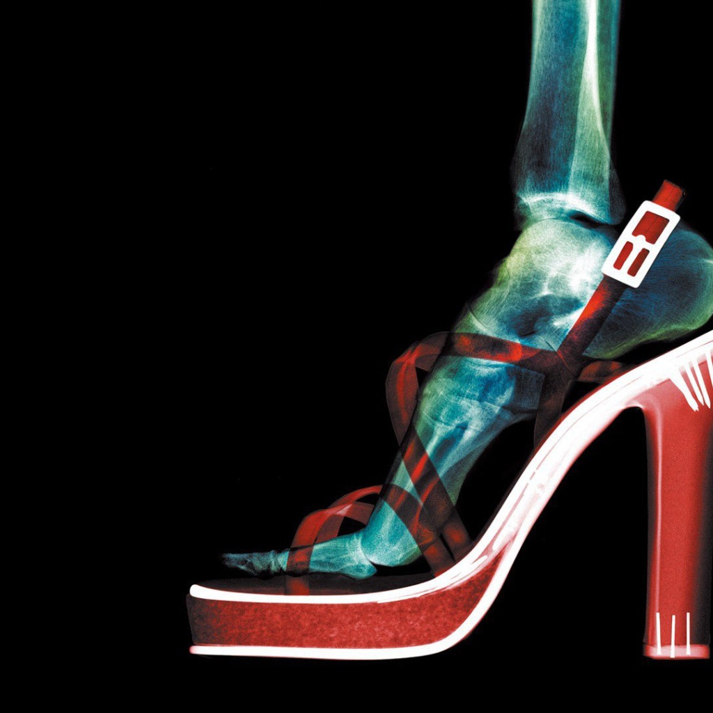 Рентген женской ноги