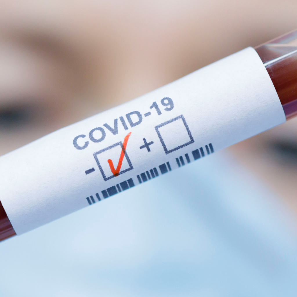 Анализ крови на коронавирус covid-19 положительный 