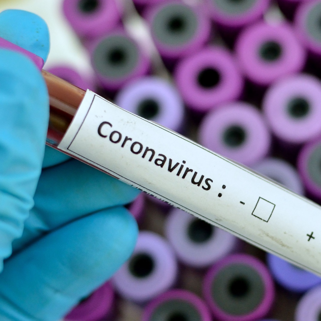 Covid-19 coronavirus test tube in hand