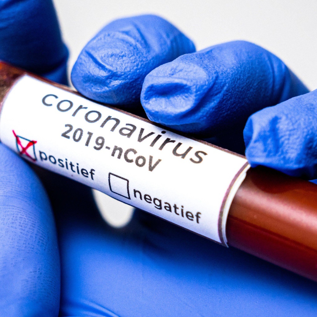 Положительный результат на коронавирус COVID-19