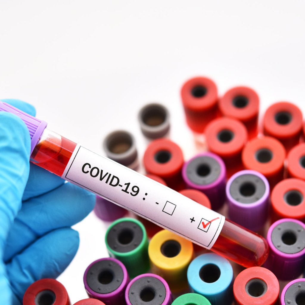 Test tubes for coronavirus covid-19, pandemic