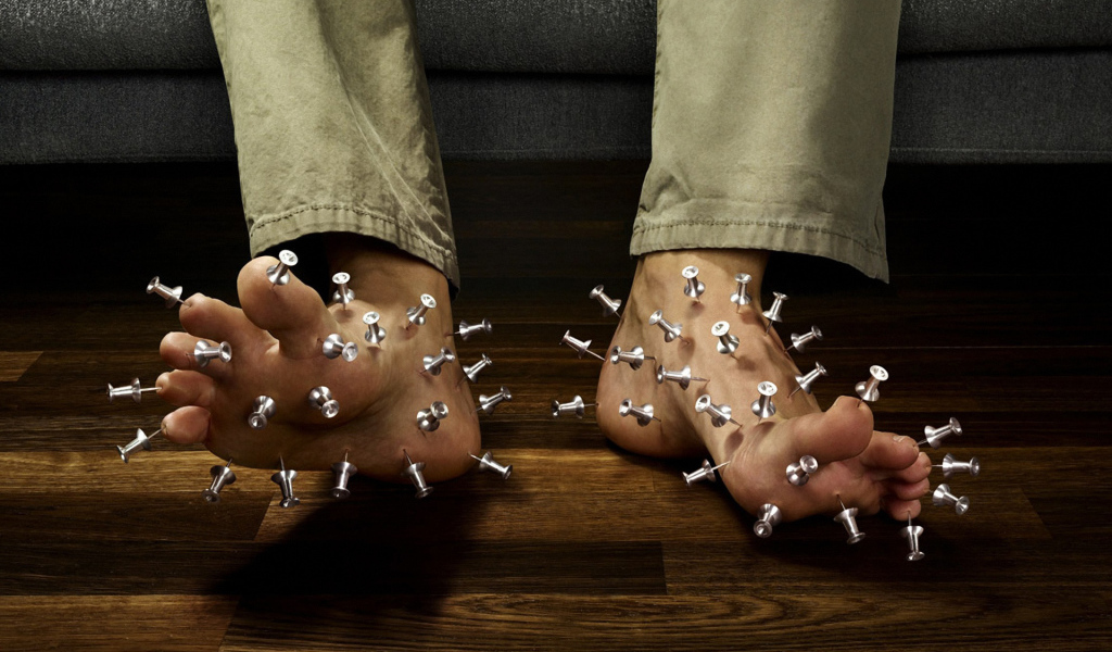 Иглотерапия