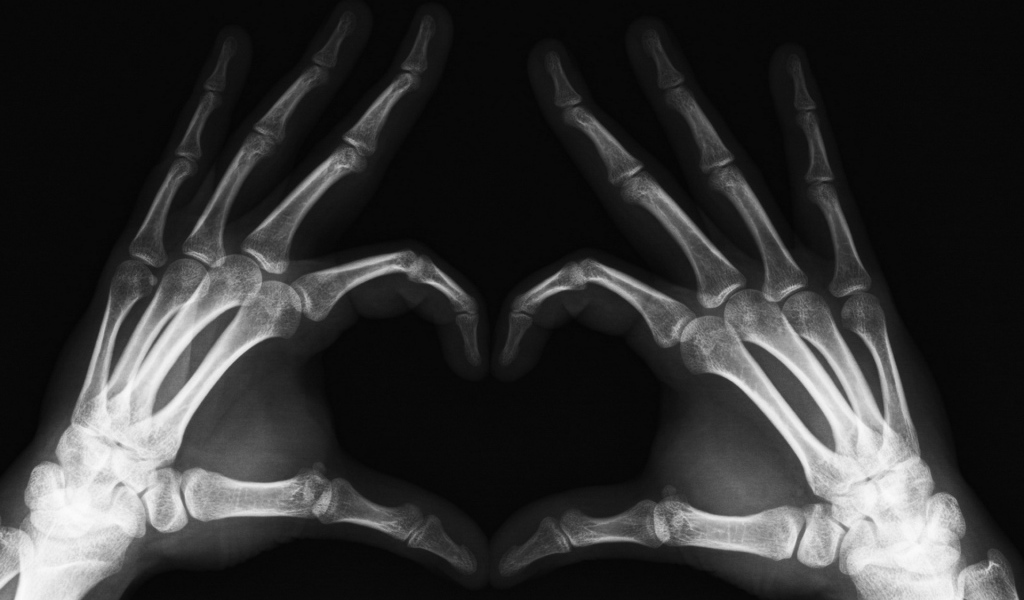 Сердце в рентгене