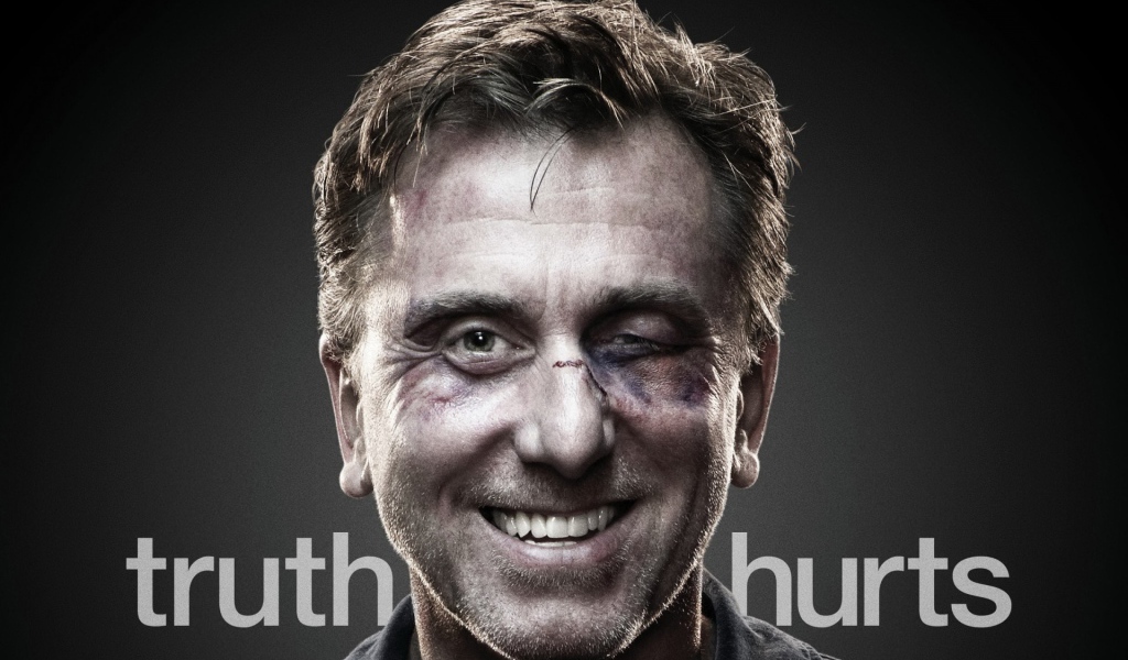 Актер с подбитым глазом