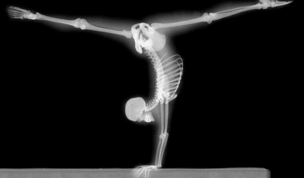 Рентген гимнаста