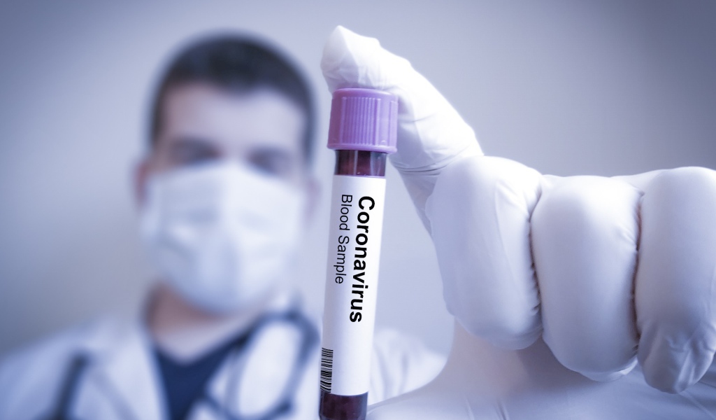 Анализ на коронавирус covid-19 в пробирке в руке