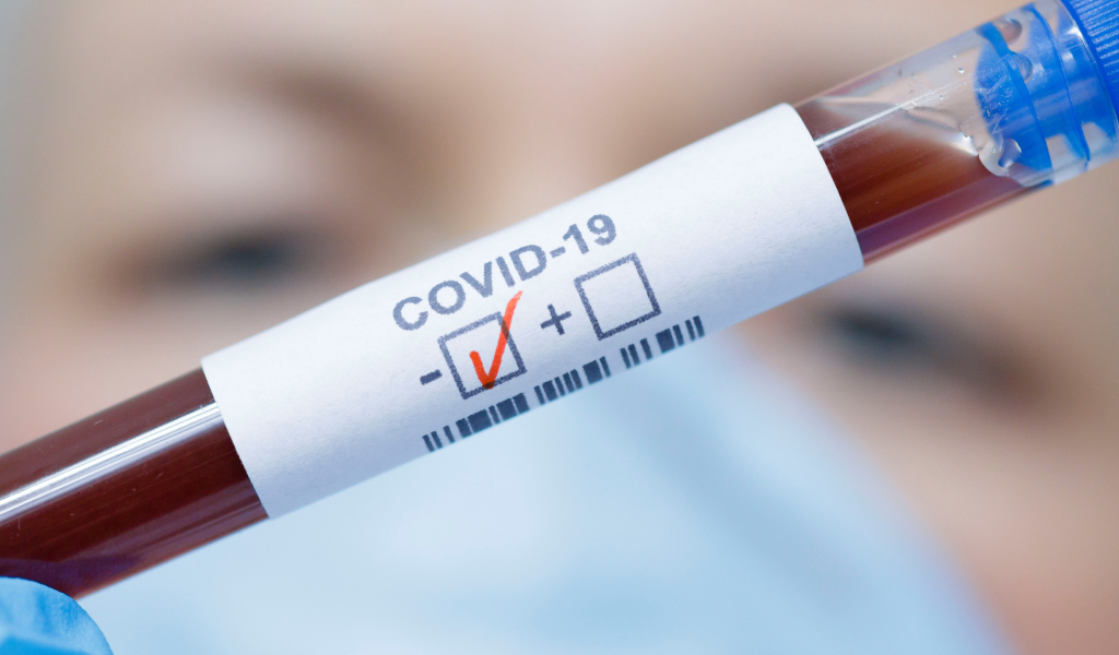 Анализ крови на коронавирус covid-19 положительный 