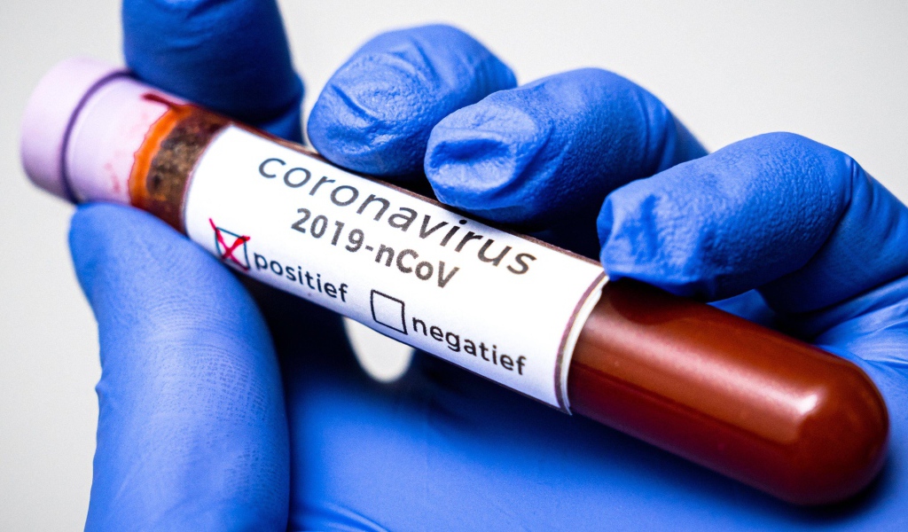 Положительный результат на коронавирус COVID-19