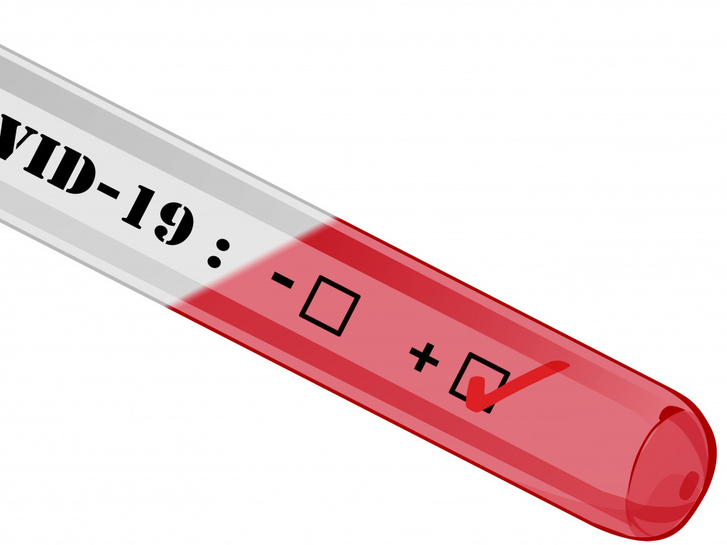 Тест на коронавирус COVID-19 на белом фоне