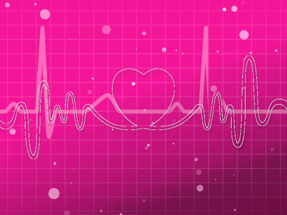 Кардиограмма влюбленного человека 