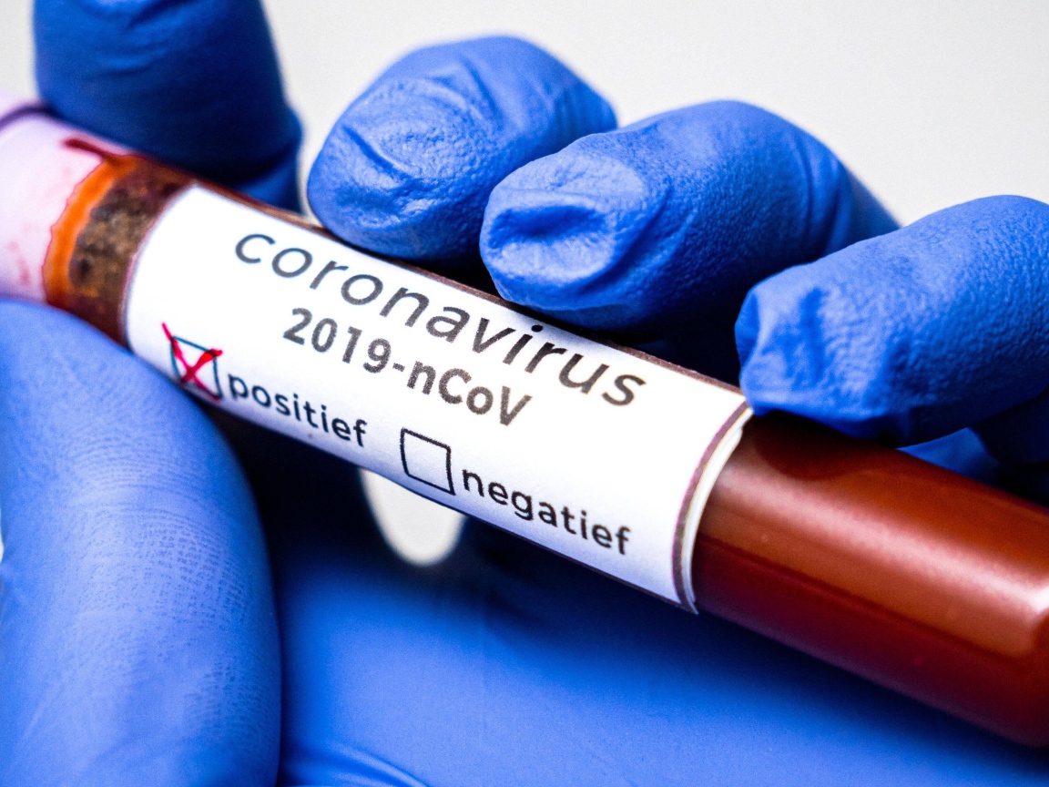 Положительный результат на коронавирус COVID-19