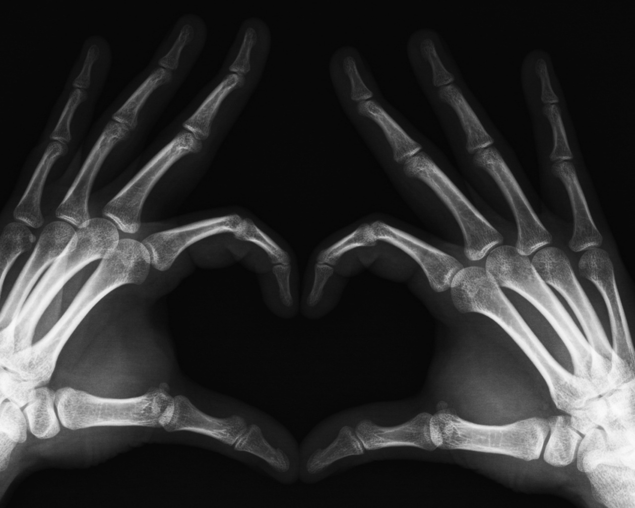 Heart of the X-ray