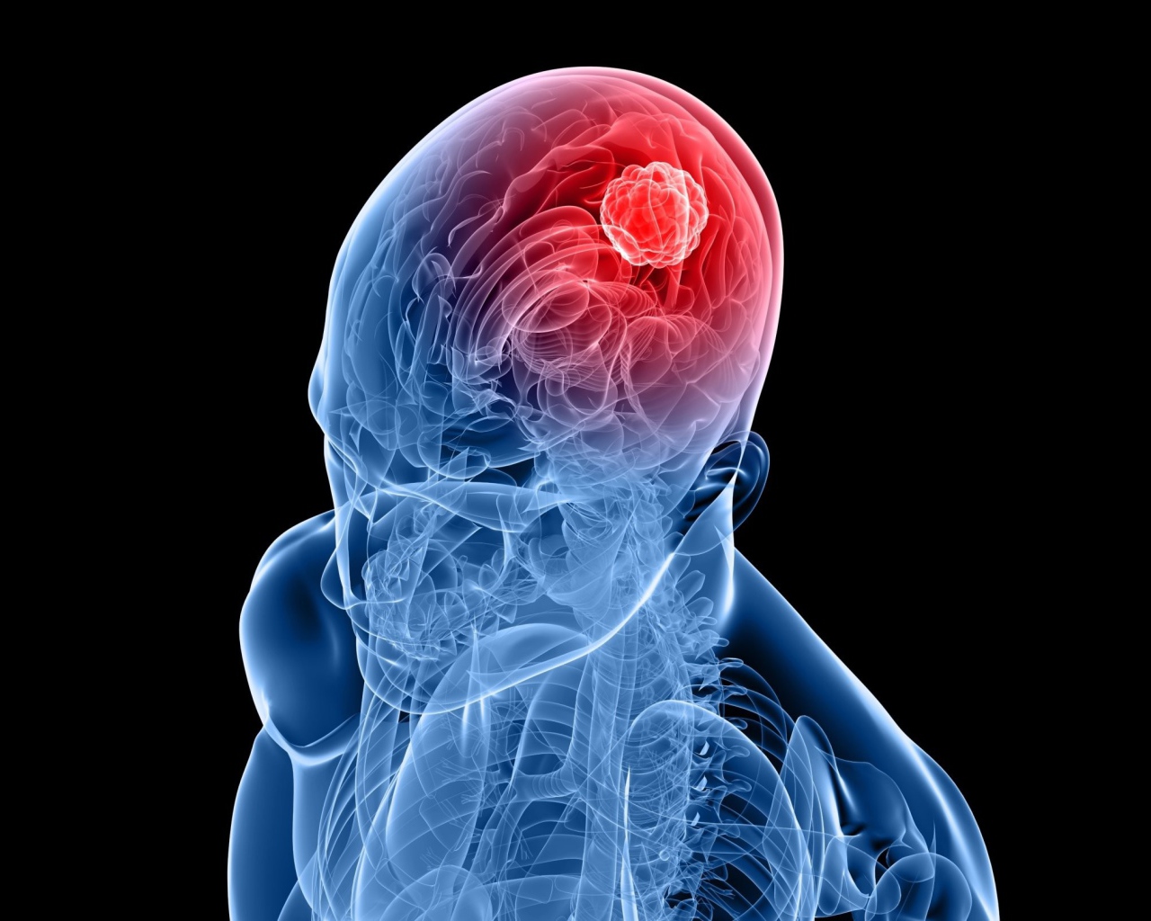 Очаг возбуждения в мозгу человека