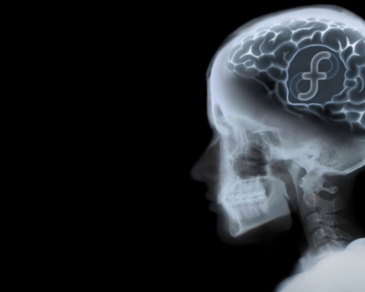 Знак ОС Fedora на рентгене