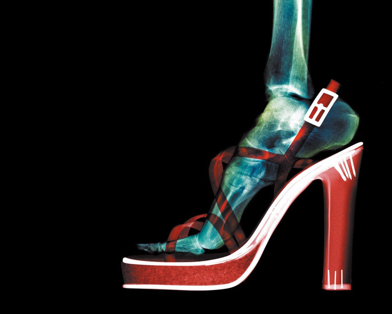 Рентген женской ноги