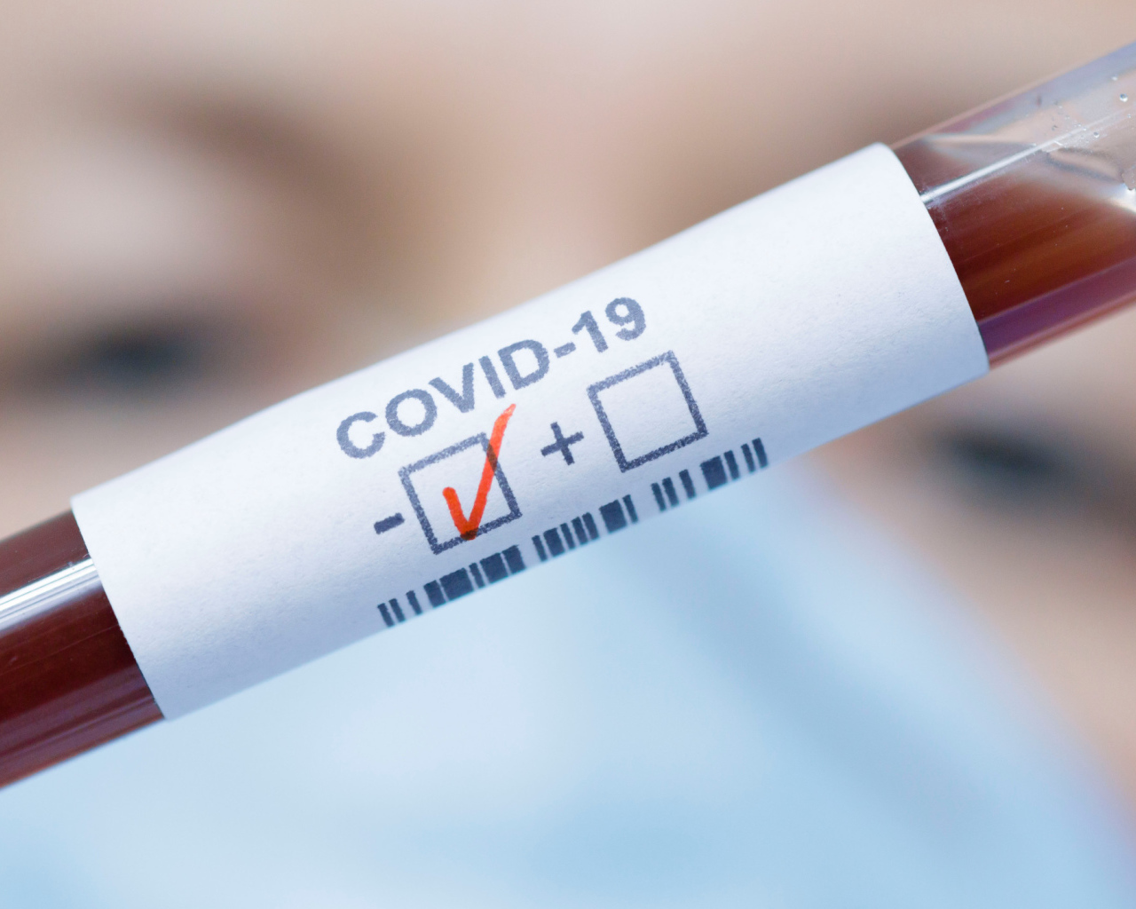 Анализ крови на коронавирус covid-19 положительный 