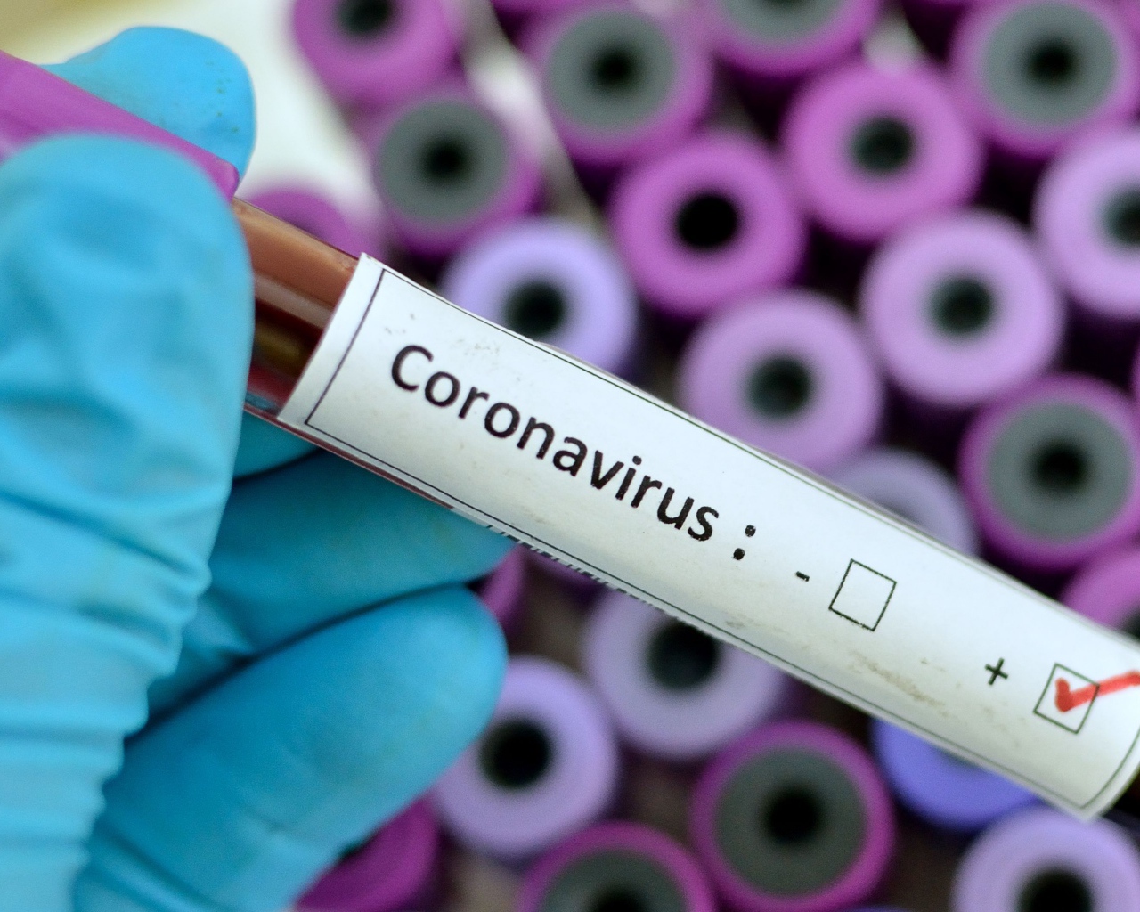 Пробирка с анализом на коронавирус covid-19 в руке