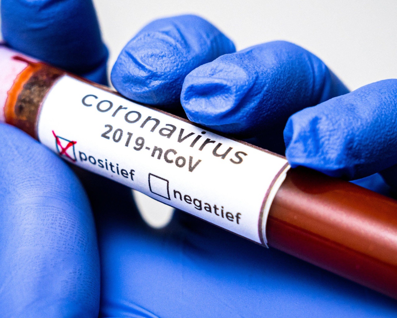 Положительный результат на коронавирус COVID-19