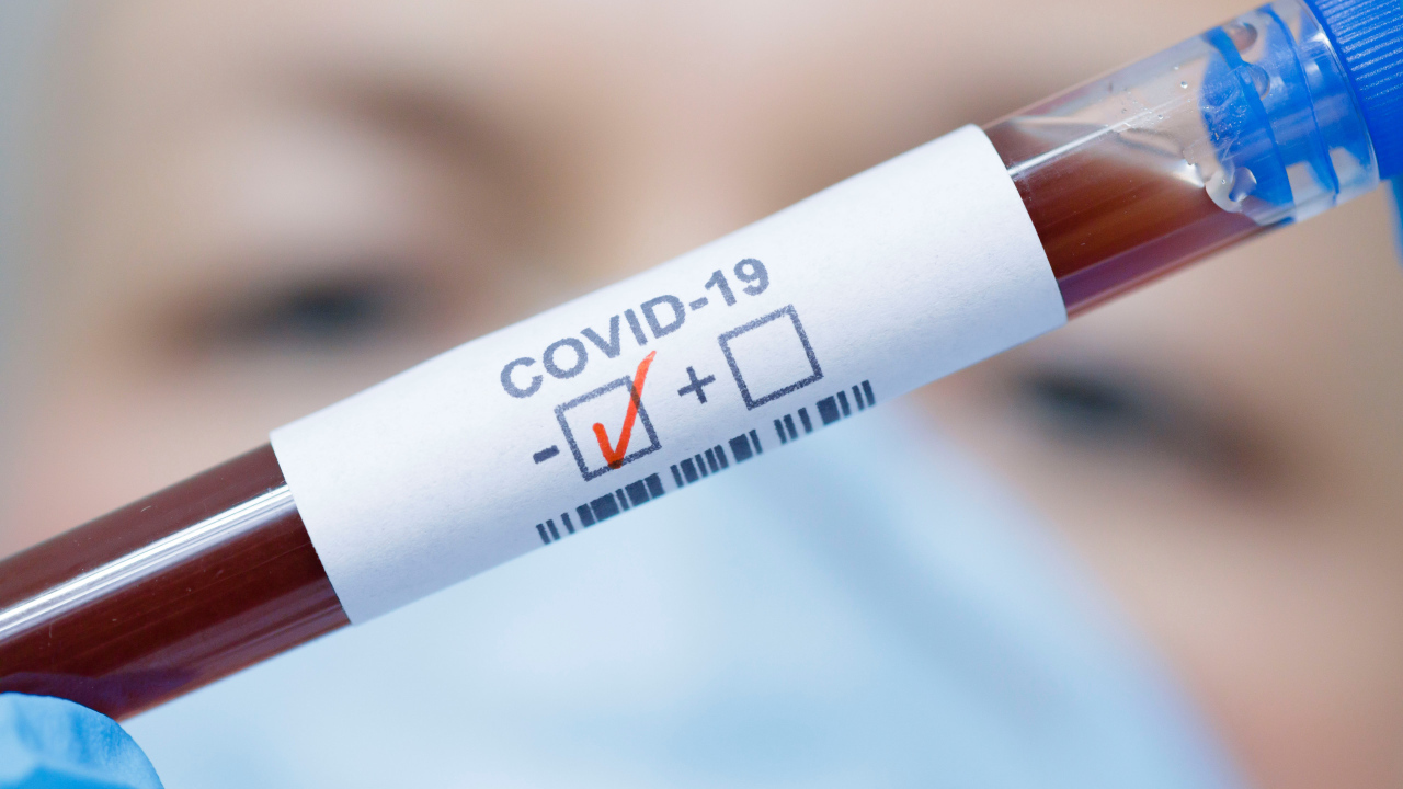 Blood test for coronavirus covid-19 positive