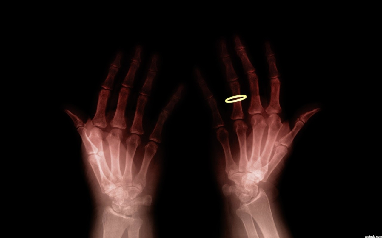 Просвечивать руки