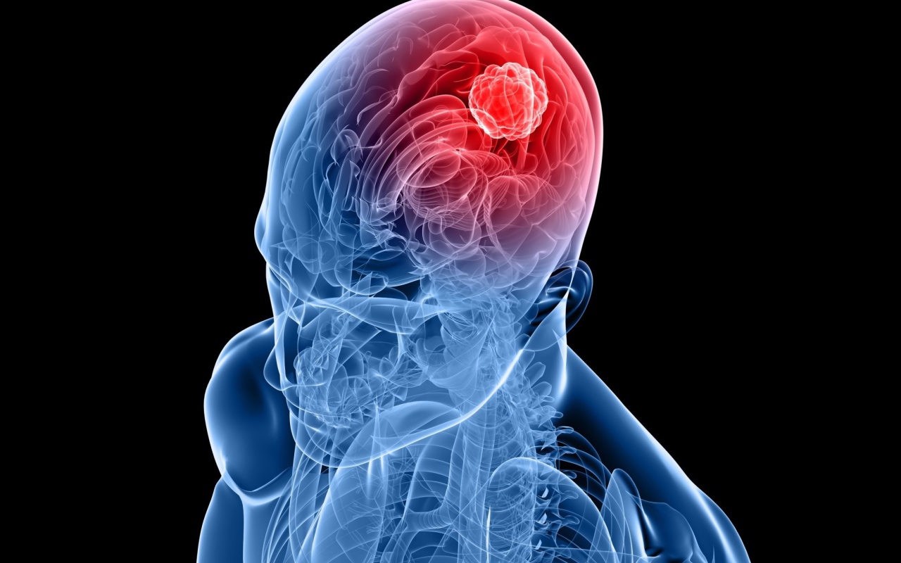 Очаг возбуждения в мозгу человека