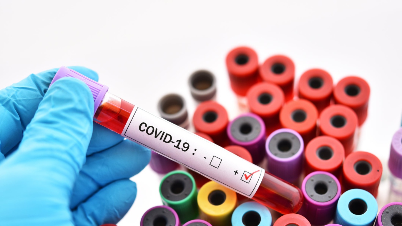 Пробирки с анализами на коронавирус covid-19, пандемия 