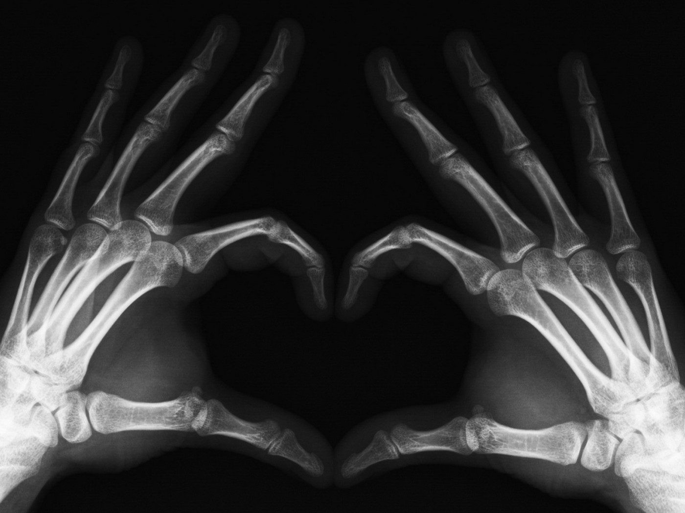 Сердце в рентгене