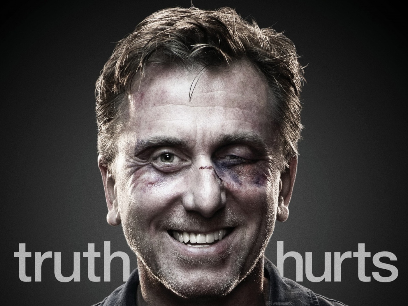 Актер с подбитым глазом