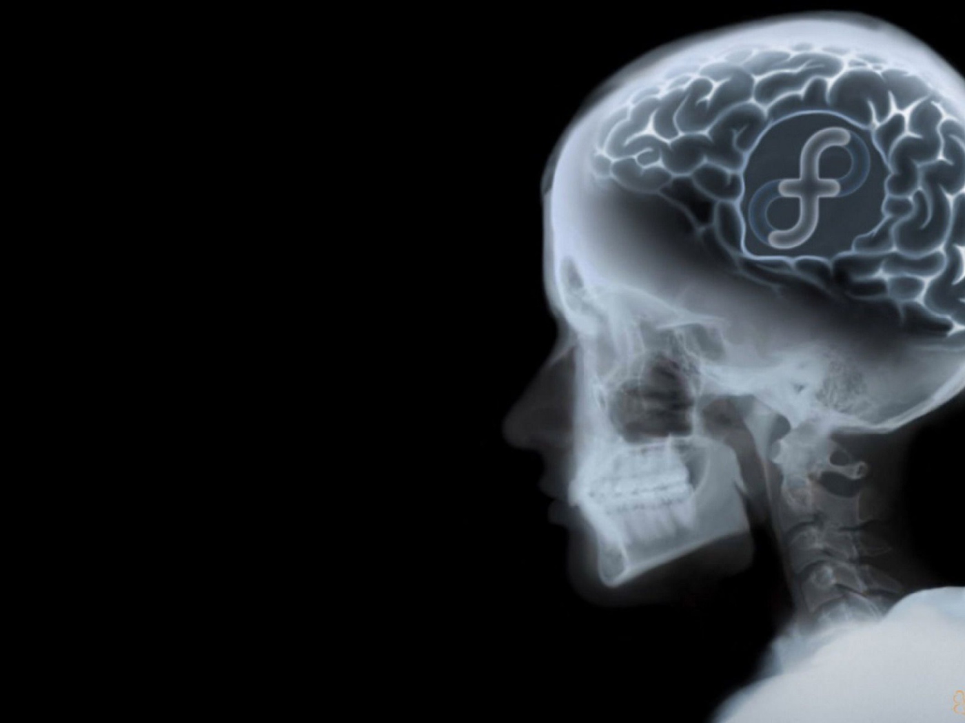 Знак ОС Fedora на рентгене