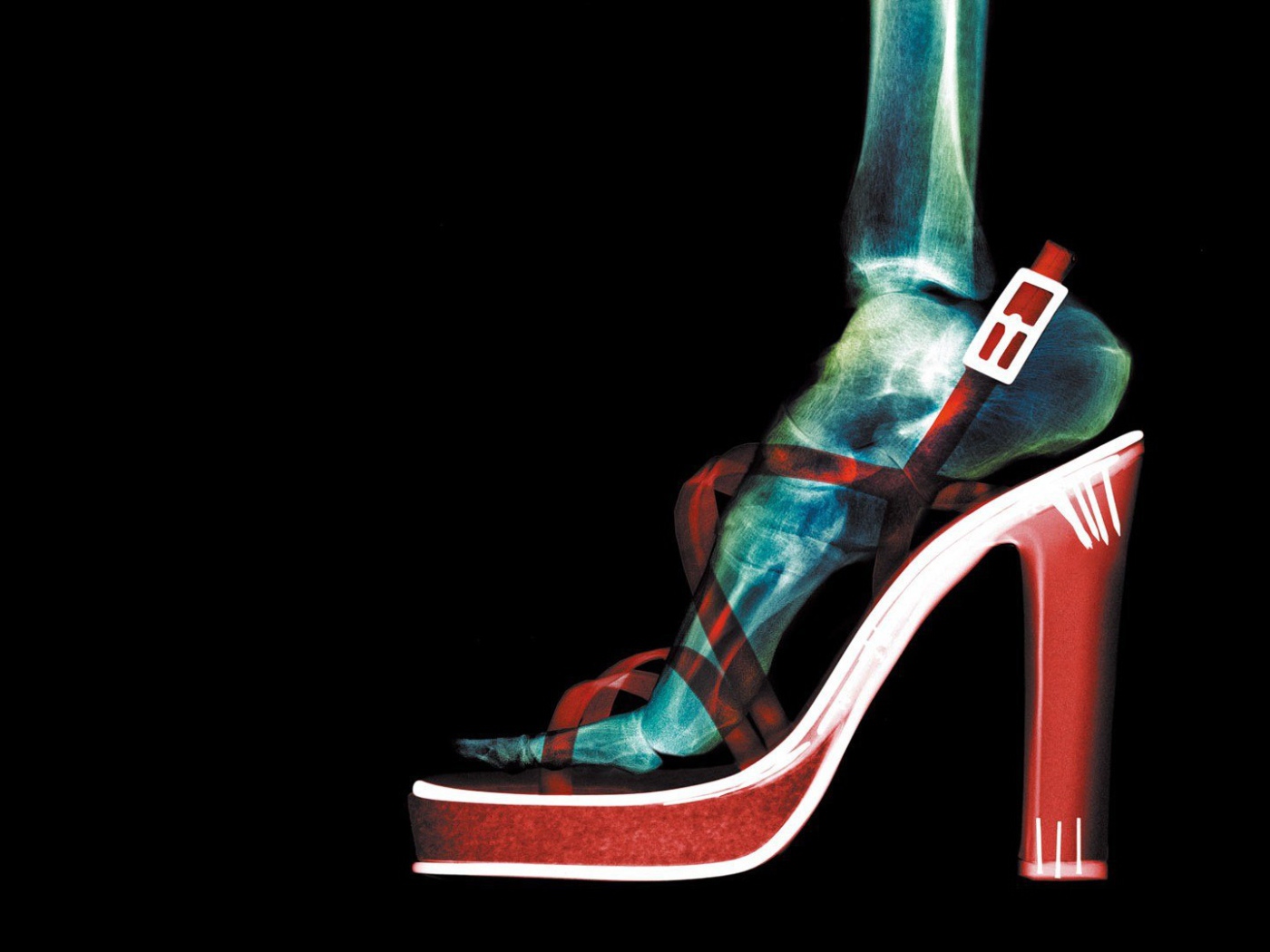 Рентген женской ноги