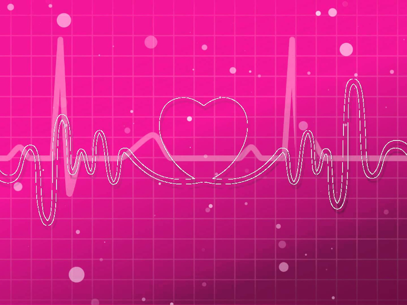 Кардиограмма влюбленного человека 