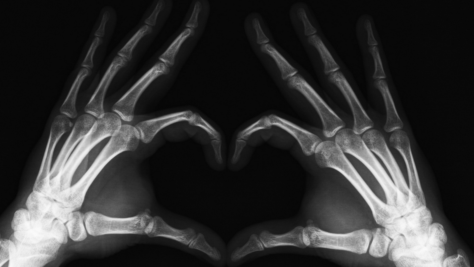 Heart of the X-ray