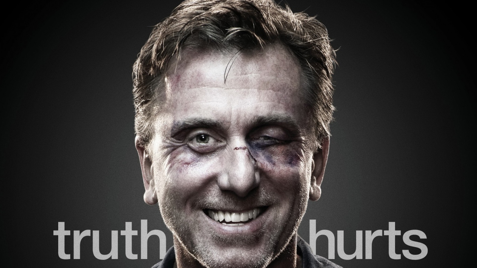 Актер с подбитым глазом