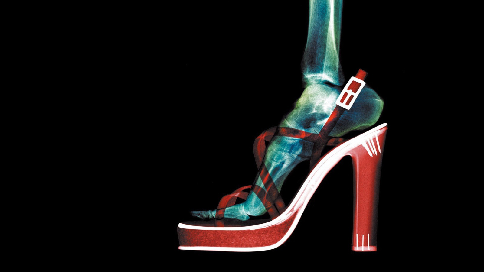 Рентген женской ноги