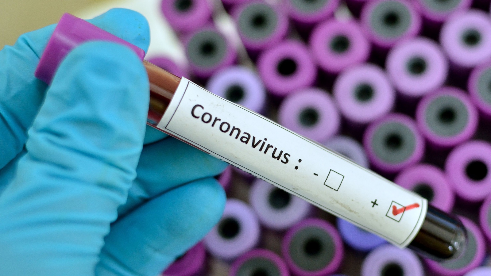 Пробирка с анализом на коронавирус covid-19 в руке