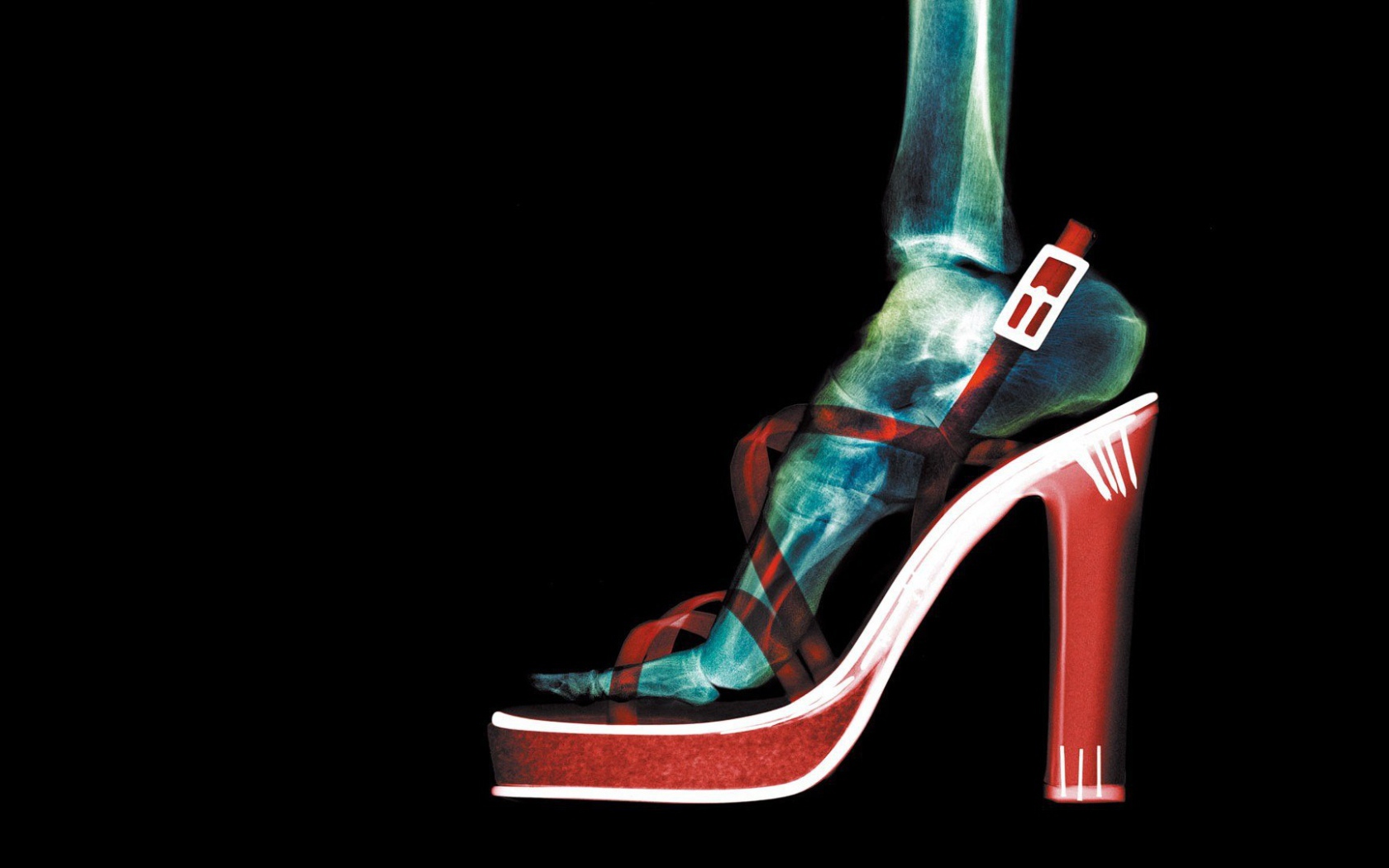 Рентген женской ноги