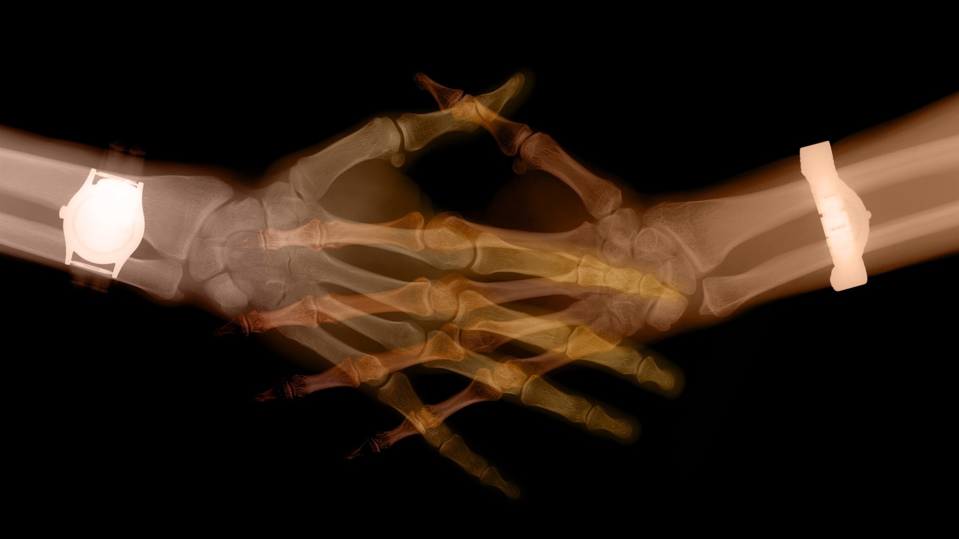 Сканер тела