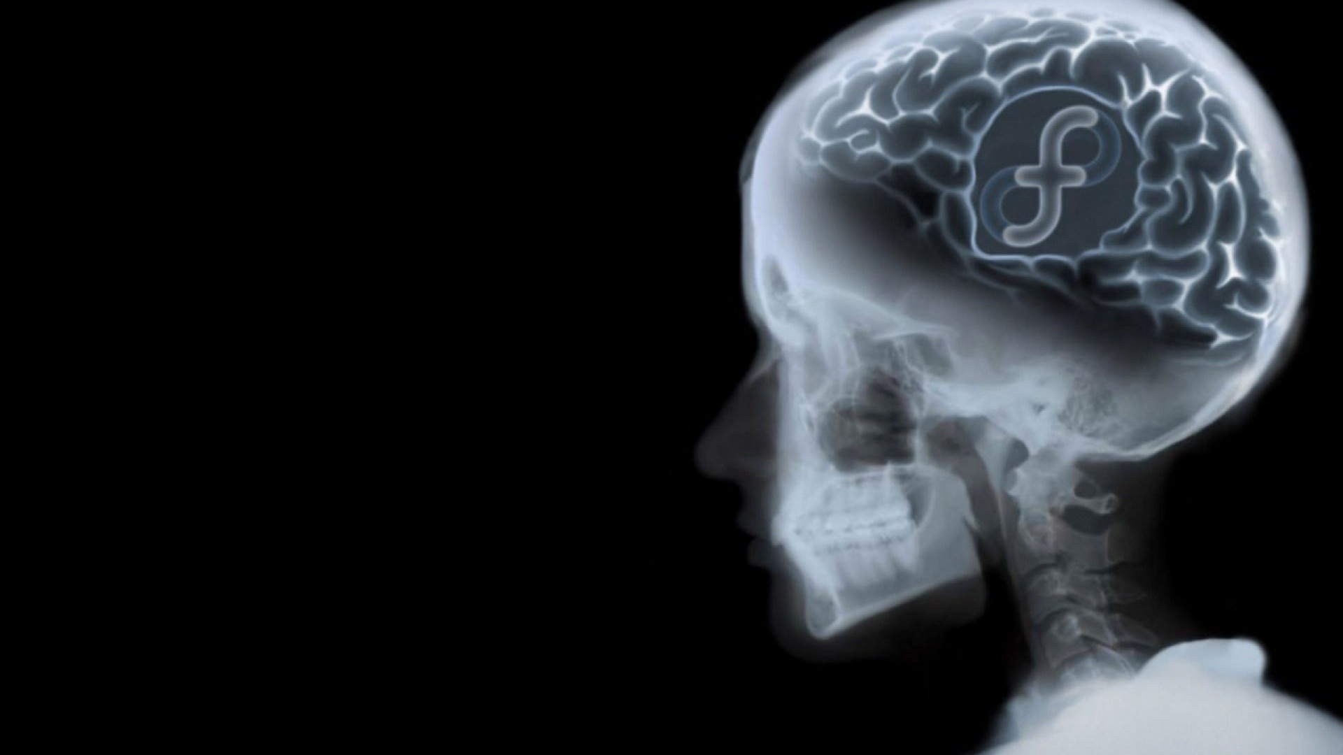 Знак ОС Fedora на рентгене