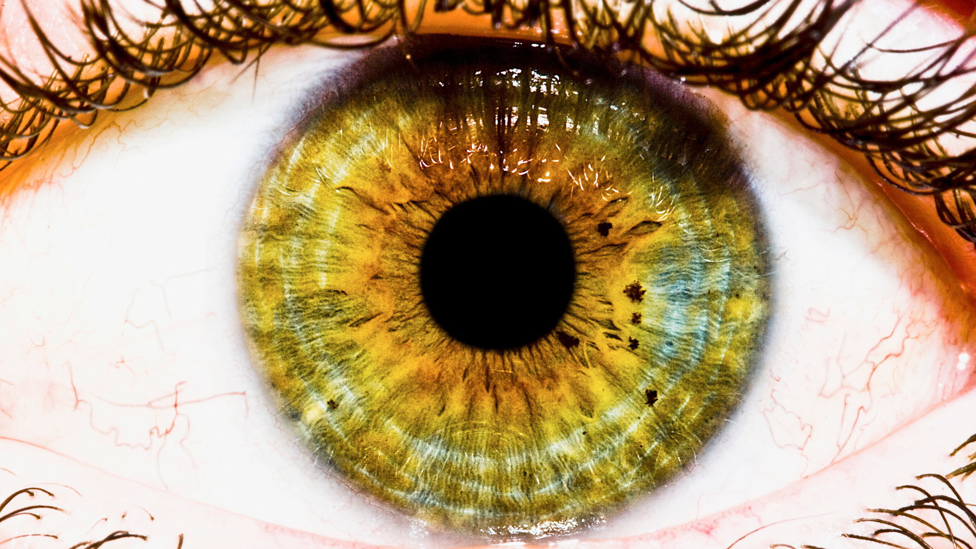 Радужная оболочка и зрачек глаза