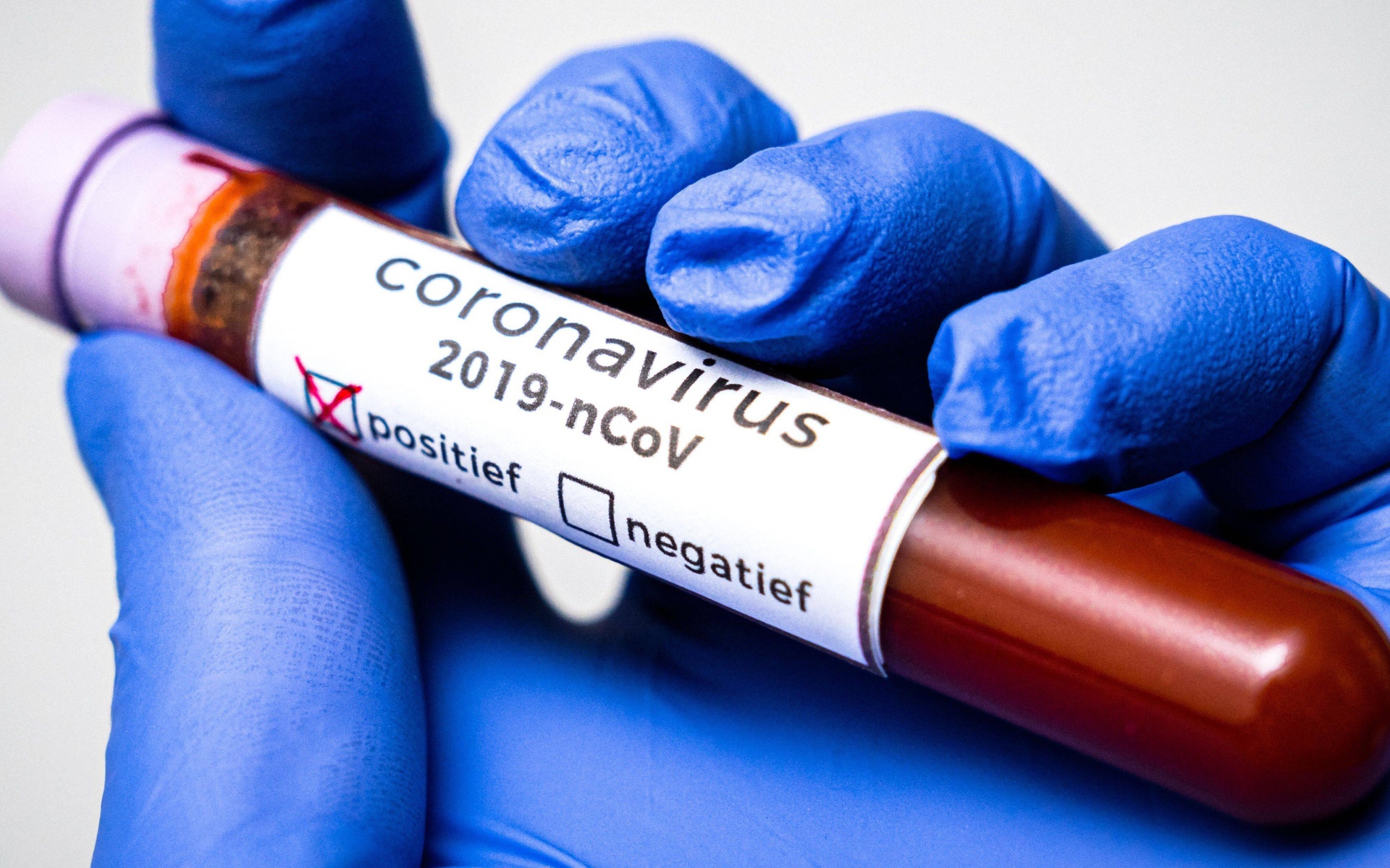 Положительный результат на коронавирус COVID-19