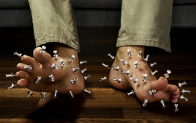 Иглотерапия